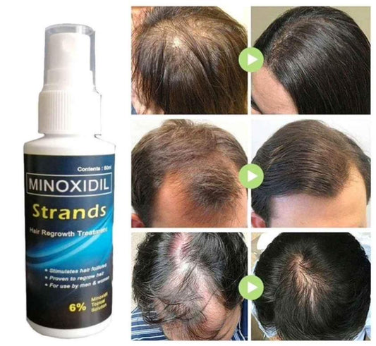 Minoxidil Strands 6%  Hairgrower For Men and Women 60ml