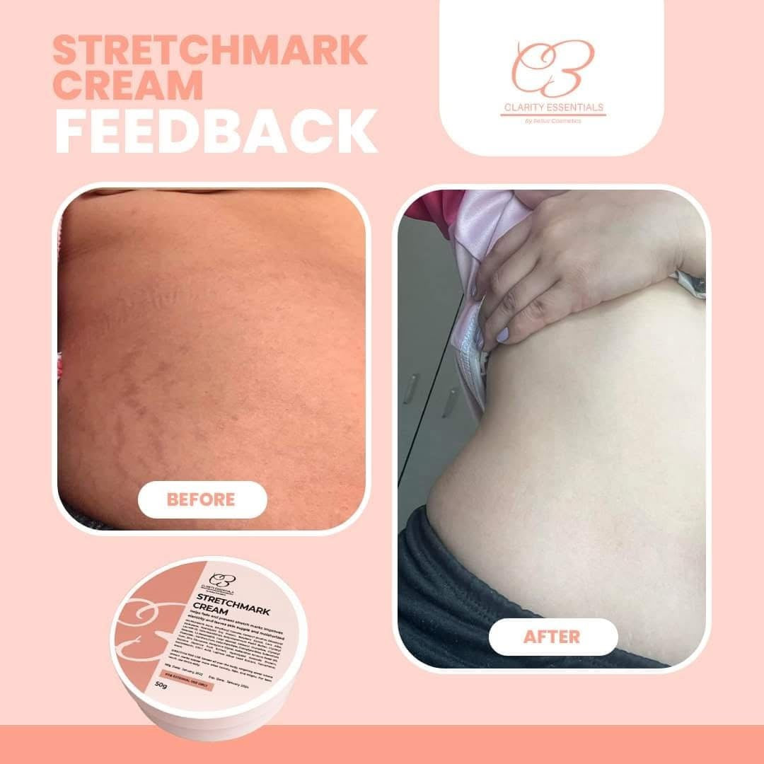 Clarity Essentials Stretchmark Cream 50g