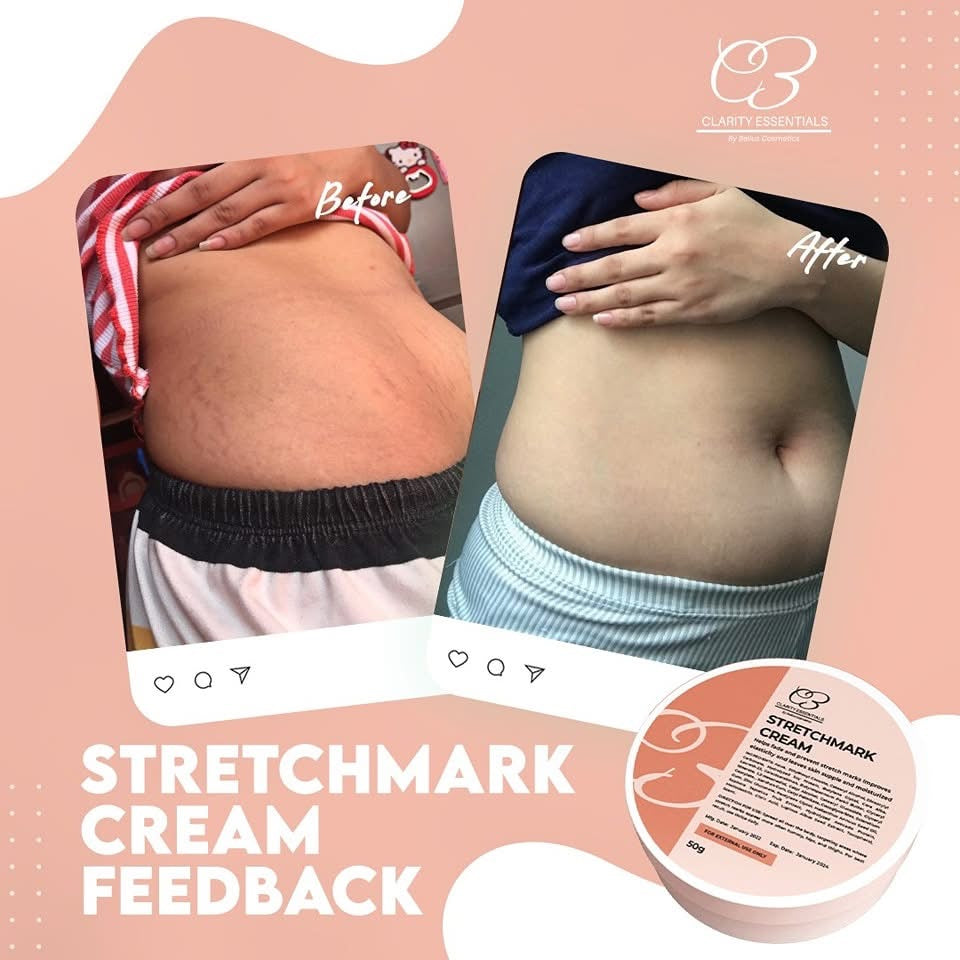 Clarity Essentials Stretchmark Cream 50g